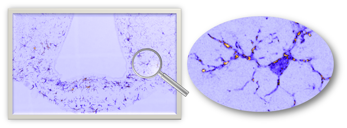 Visualisation par immunohistochimie des cellules microgliales sur une coupe de cerveau.