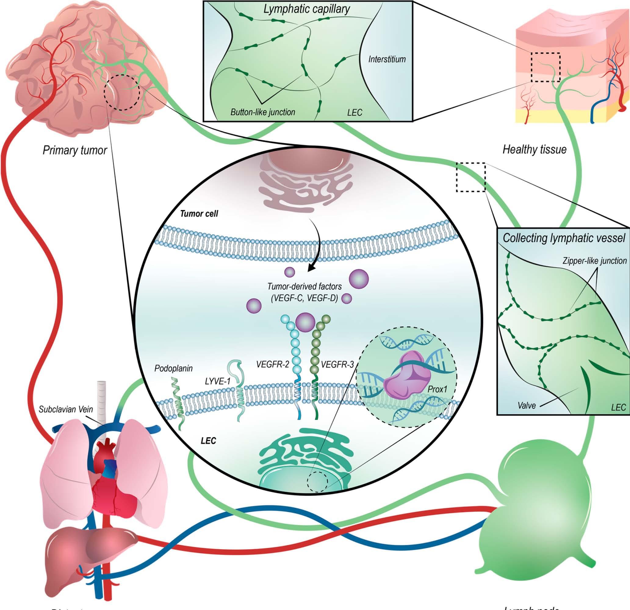 lymphangiogenesis