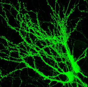 63 - Glowing Neurons