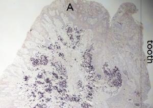 Détection par hybridation in situ, du virus Epstein Barr dans la parodontite